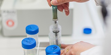 Labormitarbeiterin entnimmt Probe aus Reagenzglas.